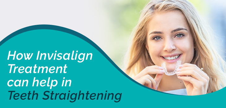 How Invisalign Treatment Can Help with Straightening Teeth
