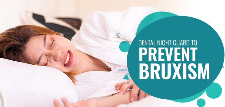 Dental Night Guard to Prevent Bruxism